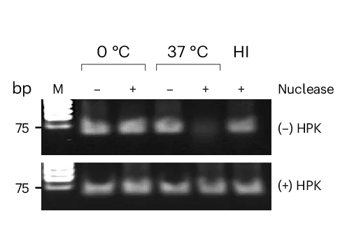Open access visualization of Gel, Gel Electrophoresis, Ethidium Bromide Staining, OND, Serum Nucleases