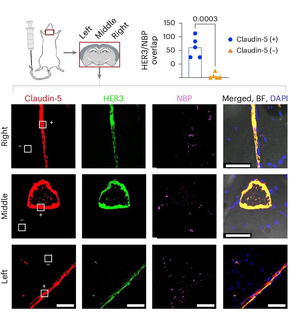 Open access visualization of Scatter Plot, Microscopy, NBP, HER3, Claudin-5-positive Areas
