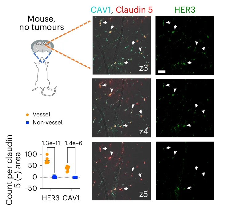Open access visualization of Microscopy, Bar Plot, HER3, Caveolin-1, Vasculature