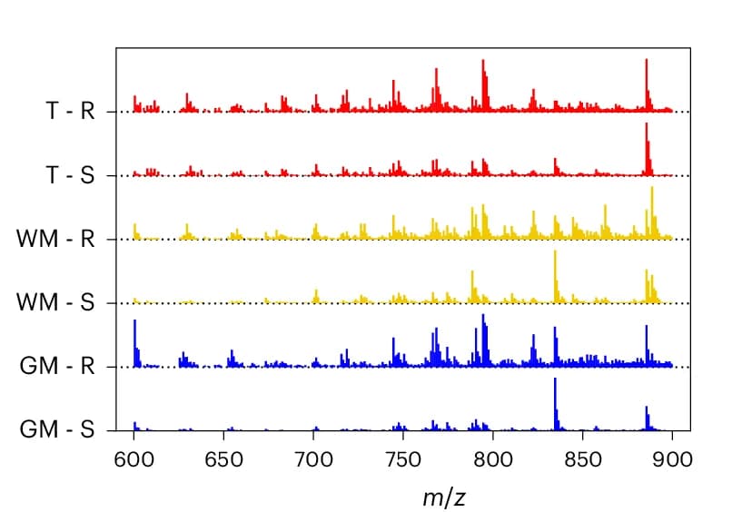 Open access visualization of Bar Plot, Histogram, Average Spectra, Normalized Counts, Grey Matter
