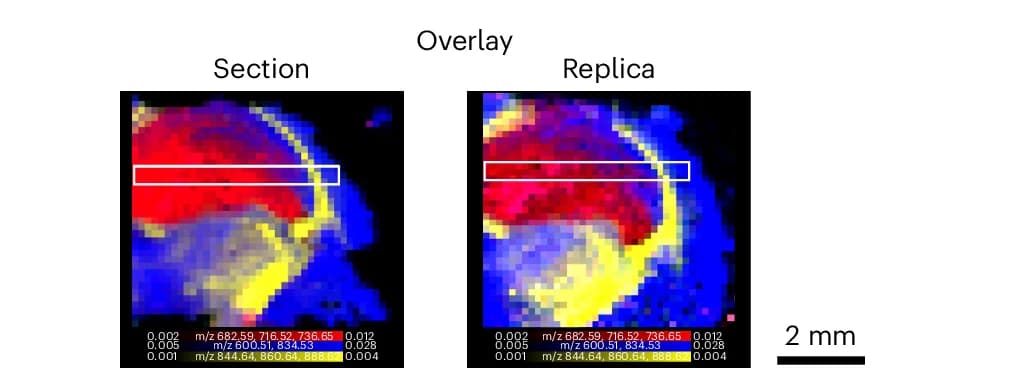 Open access visualization of Heatmap, Overlay Map, Cumulative TIC-Normalized Intensity, Grey Matter, White Matter