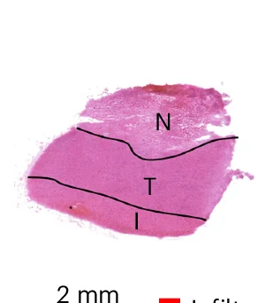 Open access visualization of Microscopy, Bright-Field Image, Haematoxylin and Eosin, H&E, HG Biopsy
