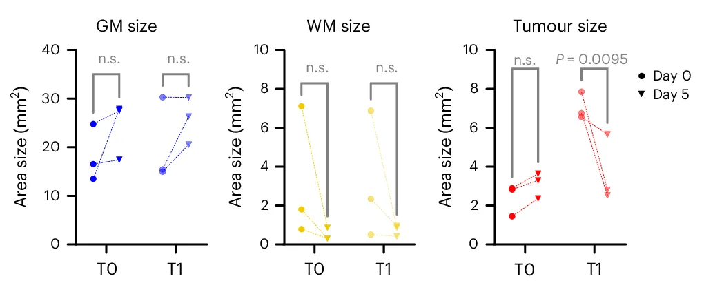 Open access visualization of Line Plot, Scatter Plot, Grey Matter, White Matter, Tumor Areas