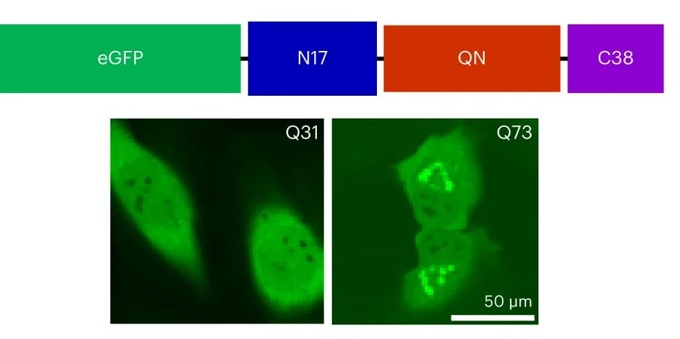 Open access visualization of Microscopy, Illustration, HeLa Cells, Lentivirus, eGFP-Htt-polyQ