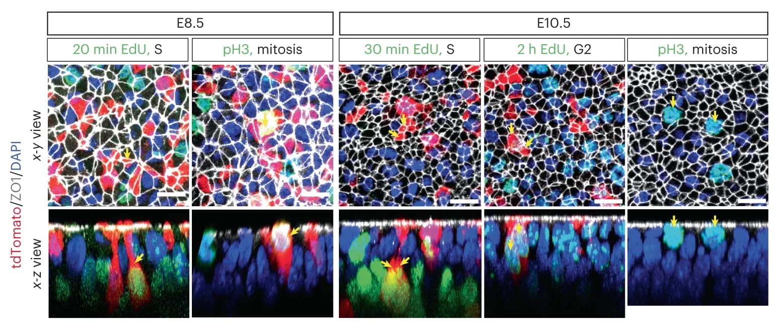 Open access visualization of Microscopy, Neuroepithelial Cells, Cell Cycle, Apical Surface, tdTomato