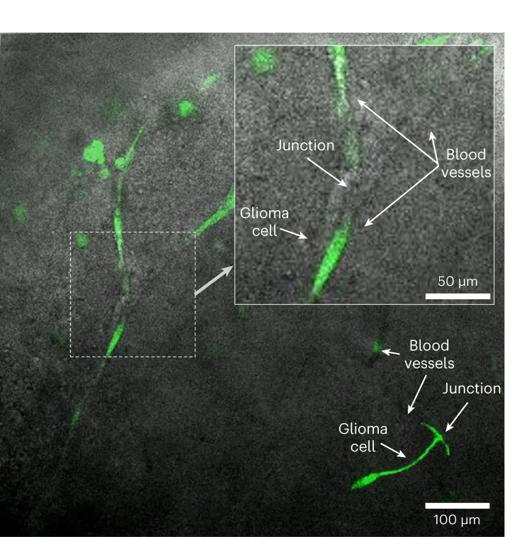 Open access visualization of Microscopy, hGPCs, Mouse Brain Slice, Blood Vessels, Cell Migration