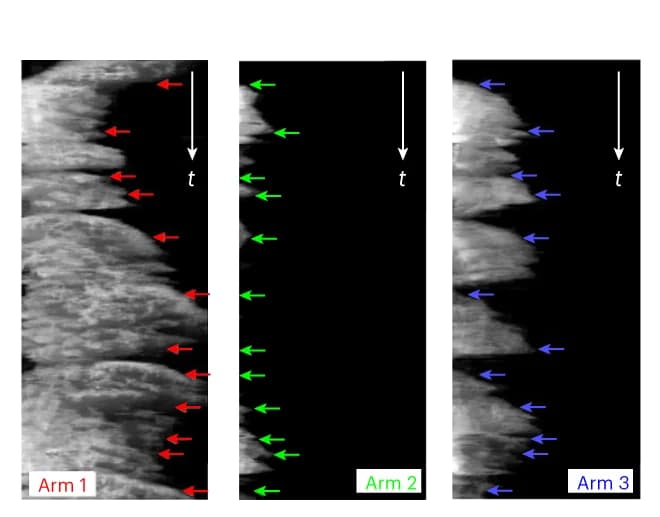 Open access visualization of Microscopy, HUVEC, Arm Kymographs, Time-Lapse Images