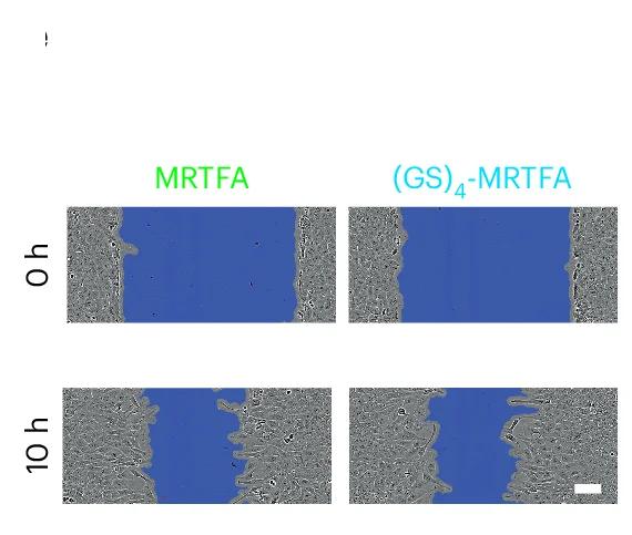 Open access visualization of Microscopy, U2OS Cells, GS-Tagged MRTFA, Cell Motility, Wound-Healing Assays
