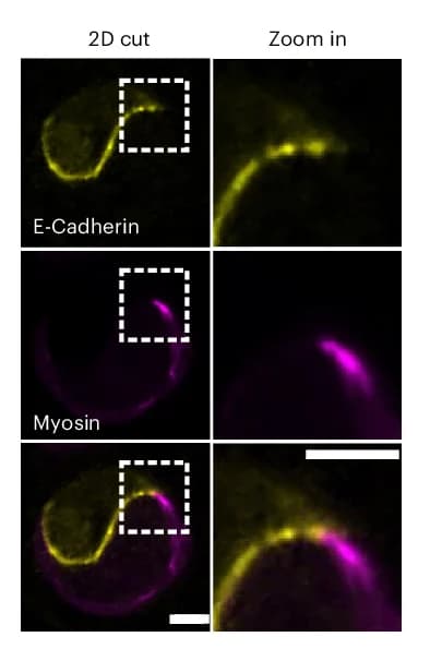 Open access visualization of Microscopy, Rotating Doublet, E-cadherin-DsRed, MRLC-GFP, Myosin