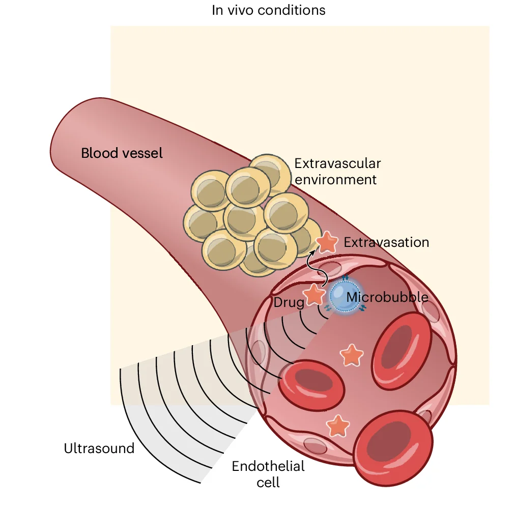 Open access visualization of Illustration, Drug Delivery, Microbubble, Ultrasound
