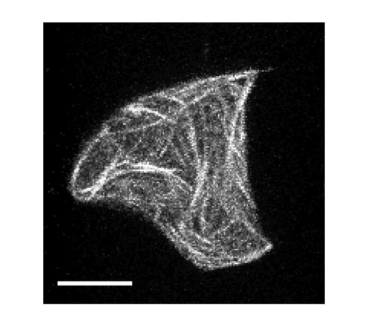 Open access visualization of Microscopy, Confocal Projection, Microtubule Network, Giant Unilamellar Vesicle Shape, Scale Bar