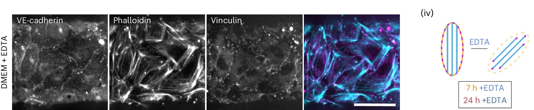 Open access visualization of Microscopy, Illustration, DMEM-Cultured Endothelium, EDTA-Treated Endothelium, VE-cadherin
