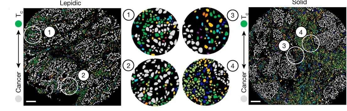 Open access visualization of Microscopy, Segmented Images, Cancer Cells, T c Cells, LUAD
