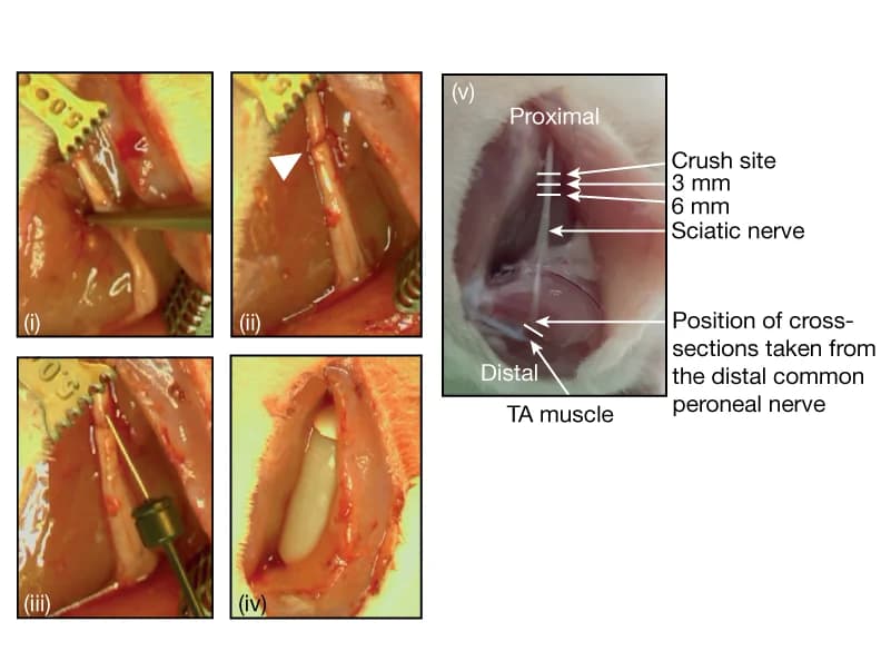 Open access visualization of Photo, Sciatic nerve crush injury, Lesion, Direct injection, dH2O