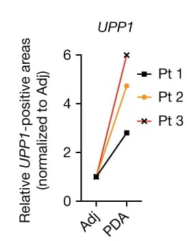 Open access visualization of Line Plot, Quantification, Patients, PDA