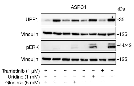Open access visualization of Gel, Western Blot, pERK, UPP1, Cell Lines