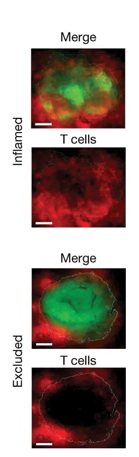 Open access visualization of Microscopy, KPP-mTagBFP2-GCaMP6 STAMP Tumors, Inflamed Immune Phenotype, Excluded Immune Phenotype, T Cells