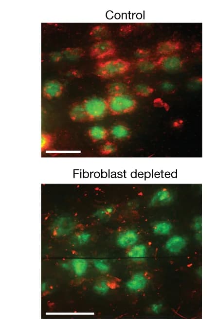 Open access visualization of Microscopy, STAMP Tumour Arrays, Fibroblasts, T Cells, Tumour Implantation