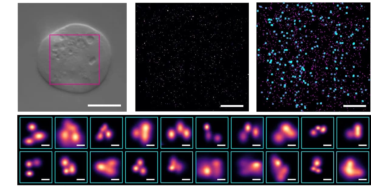 Open access visualization of Microscopy, Heatmap, Scatter Plot, PIEZO1, iPALM