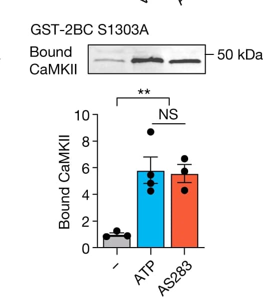 Open access visualization of Bar Plot, Error Bars, Photo, Gel, CaMKIIα