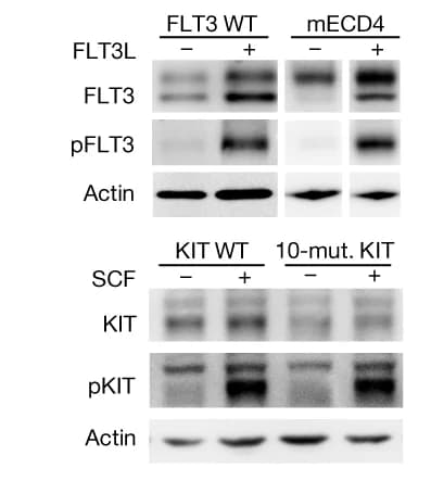 Open access visualization of Gel, Western Blot, Phosphorylated FLT3, Phosphorylated KIT, Receptor Variants