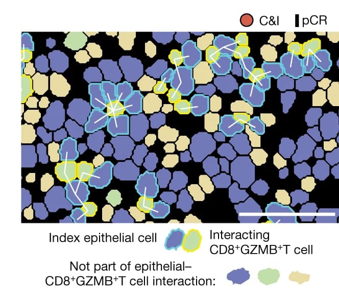 Open access visualization of Microscopy, Representative Image, Tumor, Responder, Immunotherapy