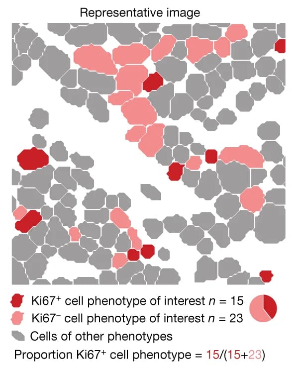 Open access visualization of Microscopy, Pie Chart, Cell Phenotype, Ki67