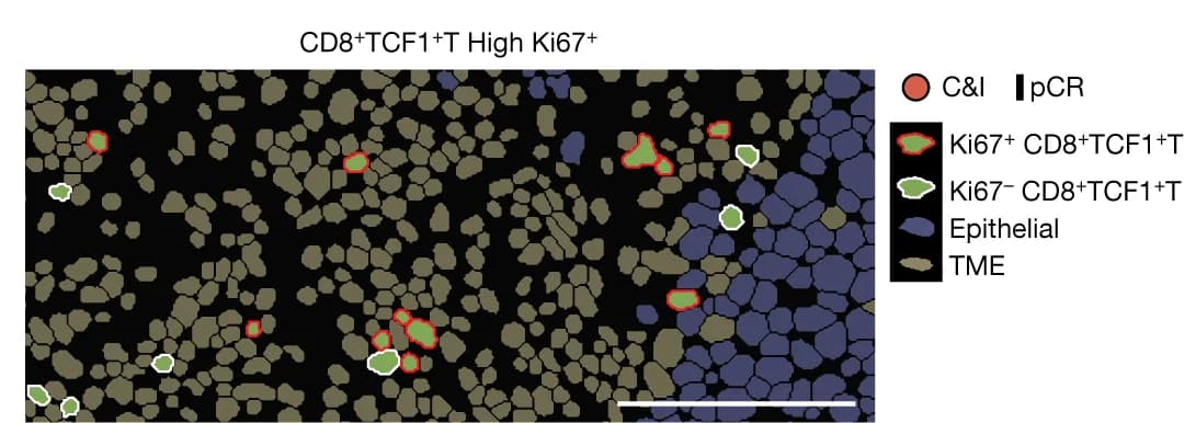 Open access visualization of Microscopy, Tumors, Immunotherapy, Responders, Proliferative Fraction