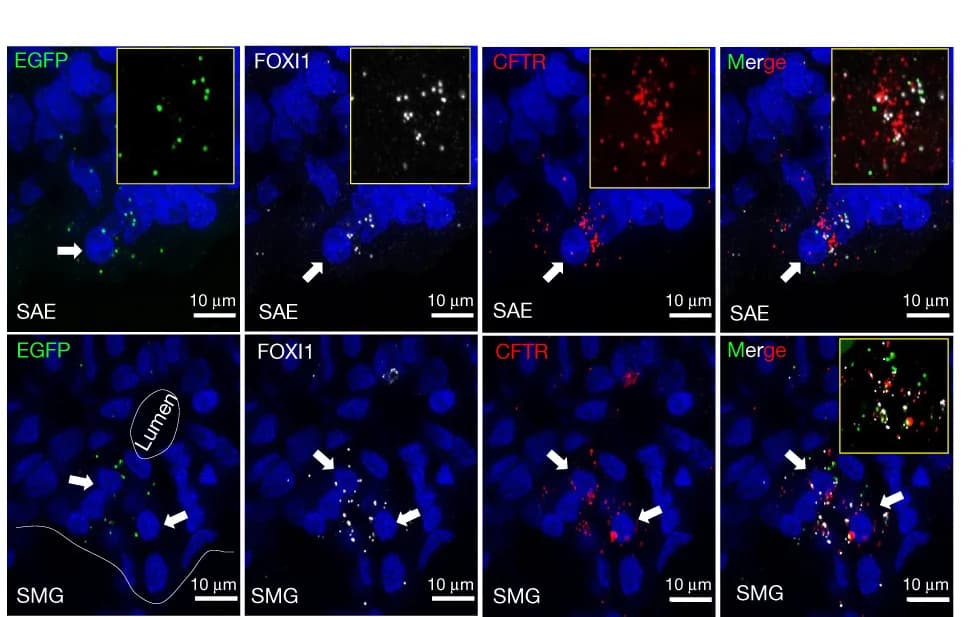 Open access visualization of Microscopy, RNAscope, EGFP, FOXI1, CFTR