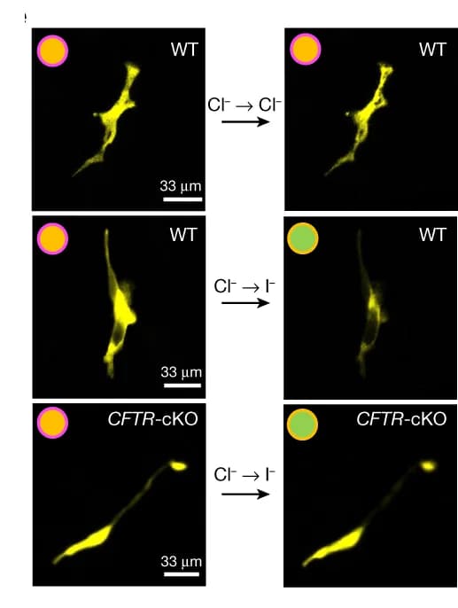 Open access visualization of Microscopy, Live-Cell Image, Pulmonary Ionocyte, YFP Fluorescence, Apical Halide Exchange