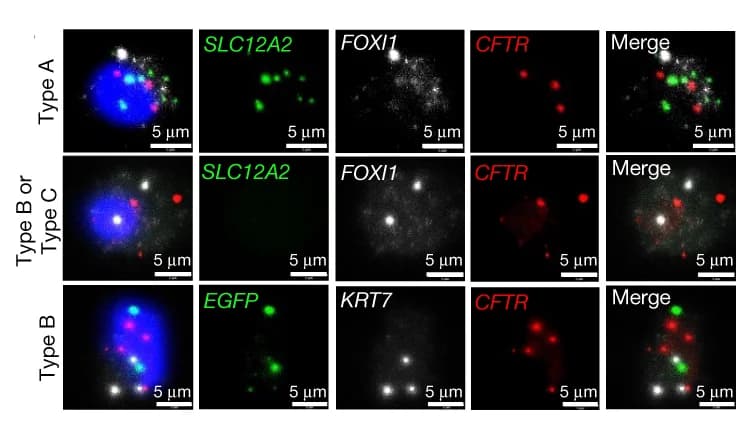 Open access visualization of Microscopy, RNAscope Validation, Ionocyte Subtypes, ALI Cultures, Cytospun Samples