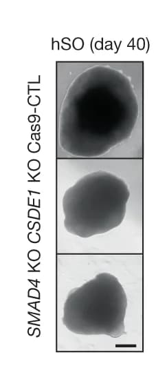 Open access visualization of Microscopy, Bright Field Images, hSO