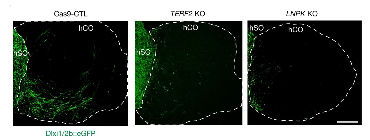 Open access visualization of Microscopy, 2D Projections, 3D Images, hFA