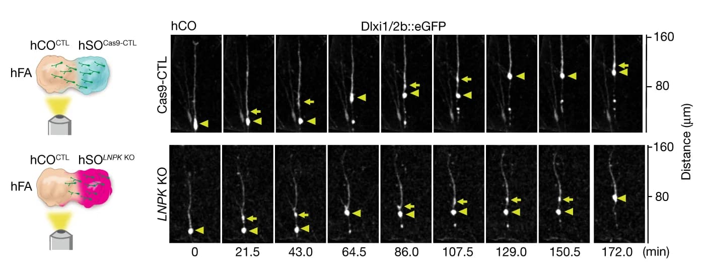 Open access visualization of Microscopy, Illustration, Saltatory Migration, Dlxi1/2b::eGFP Cells, hCO