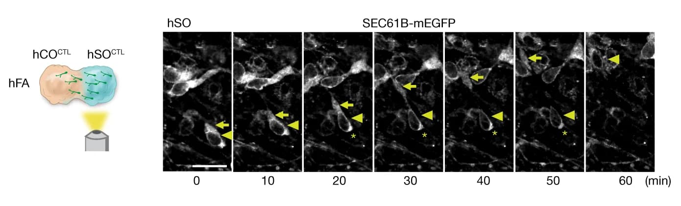 Open access visualization of Microscopy, Illustration, Time-lapse sequences, SEC61B-mEGFP + cells, Saltatory pattern