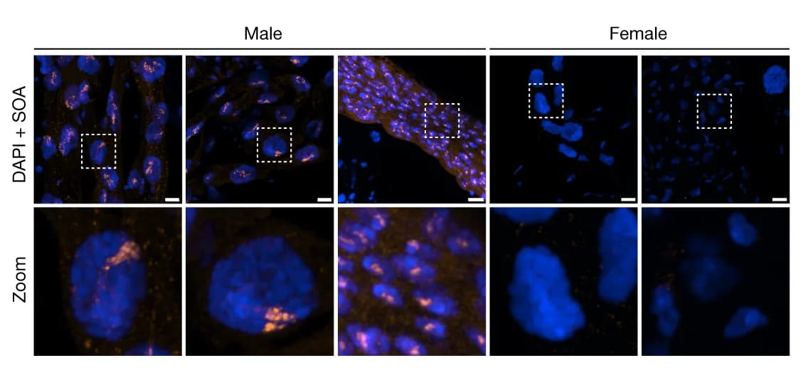 Open access visualization of Microscopy, SOA immunostaining, DAPI, Adult mosquito tissues, Malpighian tubules