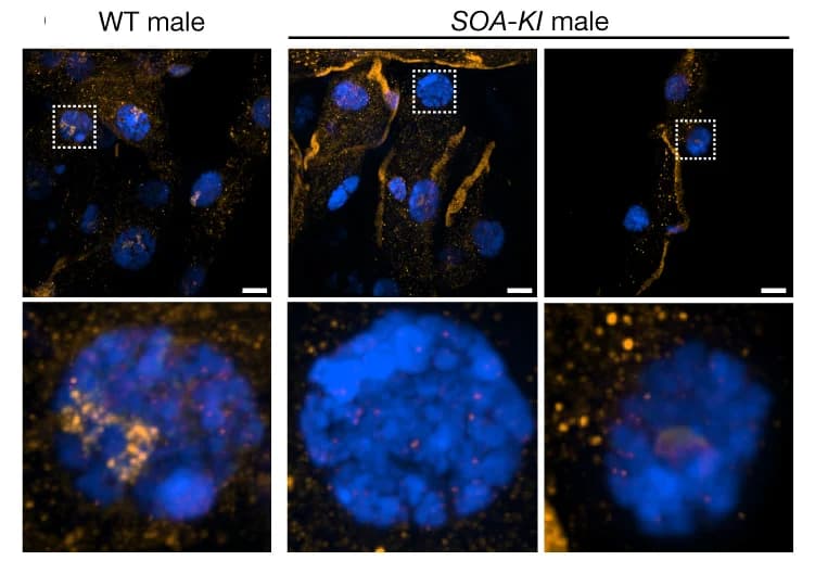 Open access visualization of Microscopy, SOA Immunostaining, DAPI, Wild-type, SOA-KI