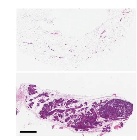 Open access visualization of Microscopy, Mammary Gland, DDR-CRISPR Lentiviral Injection, Haematoxylin and Eosin