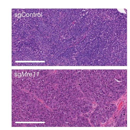 Open access visualization of Microscopy, Mammary Tumors, Cre-sgControl, Cre-sg Mre11, Haematoxylin and Eosin