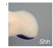 Open access visualization of Photo, In Situ Hybridization, Shh, WT Hindlimb, Limb Bud