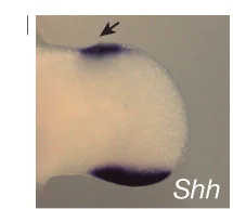 Open access visualization of Photo, In Situ Hybridization, Shh, Syn 0.52 Homozygous Mouse Hindlimb, Limb Bud