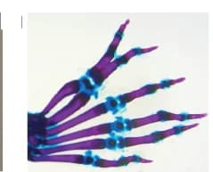 Open access visualization of Photo, Skeletal Staining, Homozygous Syn 0.52 ETS-A Mouse Hindlimb, Digits
