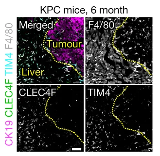 Open access visualization of Microscopy, Immunofluorescence, F4/80, TIM4, CLEC4F
