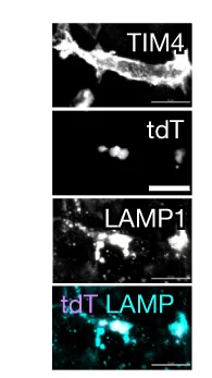 Open access visualization of Microscopy, tdT, LAMP1, Kupffer Cells
