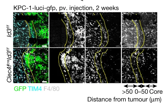 Open access visualization of Microscopy, Immunofluorescence, GFP, TIM4, F4/80