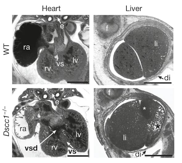 Open access visualization of Microscopy, Heart, Liver, Mouse Embryos, Ventricular Septal Defect
