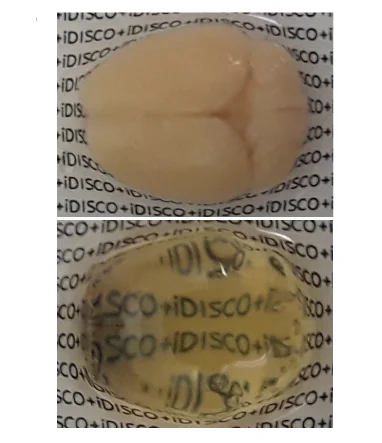 Open access visualization of Photo, Mouse Brain, iDISCO