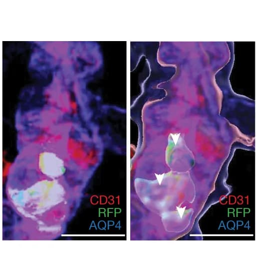 Open access visualization of Microscopy, Z-Stack, Confocal Image, NAc, Blood Vessels