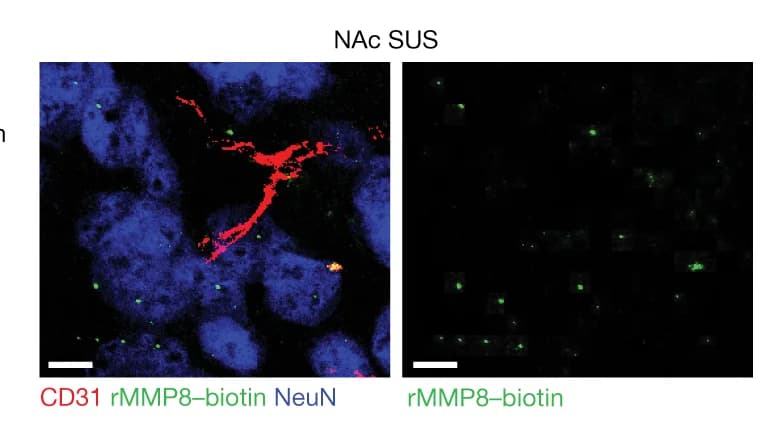Open access visualization of Microscopy, Experimental Outline, Immunofluorescence Image, NAc, Mice