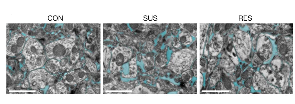 Open access visualization of Microscopy, Transmission Electron Microscopy, ECS, NAc, TEM
